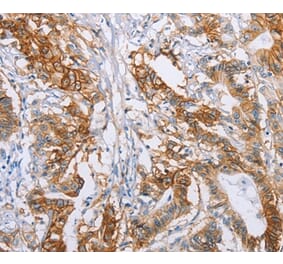 Immunohistochemistry - CA9 Antibody from Signalway Antibody (35663) - Antibodies.com