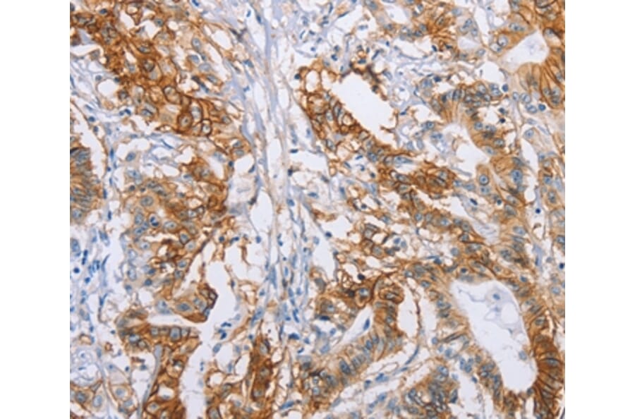 Immunohistochemistry - CA9 Antibody from Signalway Antibody (35663) - Antibodies.com