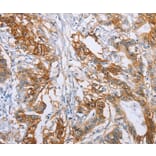 Immunohistochemistry - CA9 Antibody from Signalway Antibody (35663) - Antibodies.com