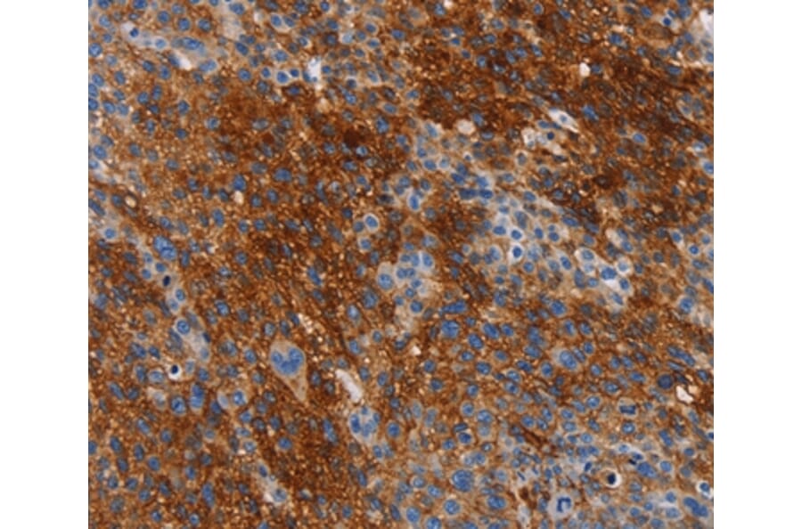 Immunohistochemistry - CA9 Antibody from Signalway Antibody (35663) - Antibodies.com