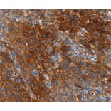 Immunohistochemistry - CA9 Antibody from Signalway Antibody (35663) - Antibodies.com