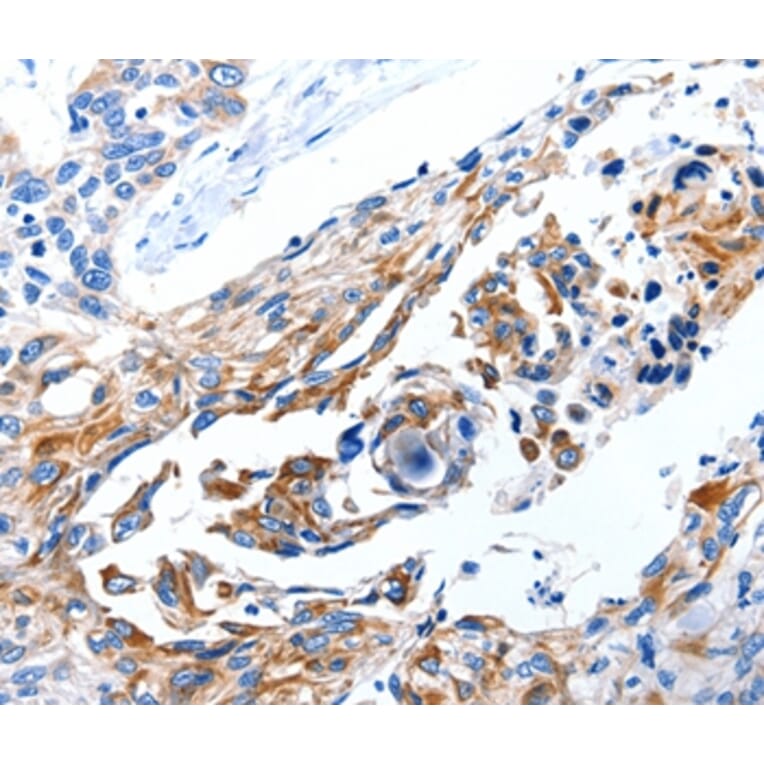 Immunohistochemistry - DAP Antibody from Signalway Antibody (35710) - Antibodies.com