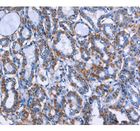 Immunohistochemistry - MPO Antibody from Signalway Antibody (35820) - Antibodies.com