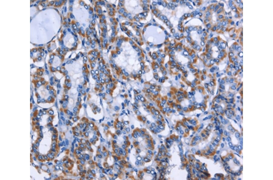 Immunohistochemistry - MPO Antibody from Signalway Antibody (35820) - Antibodies.com