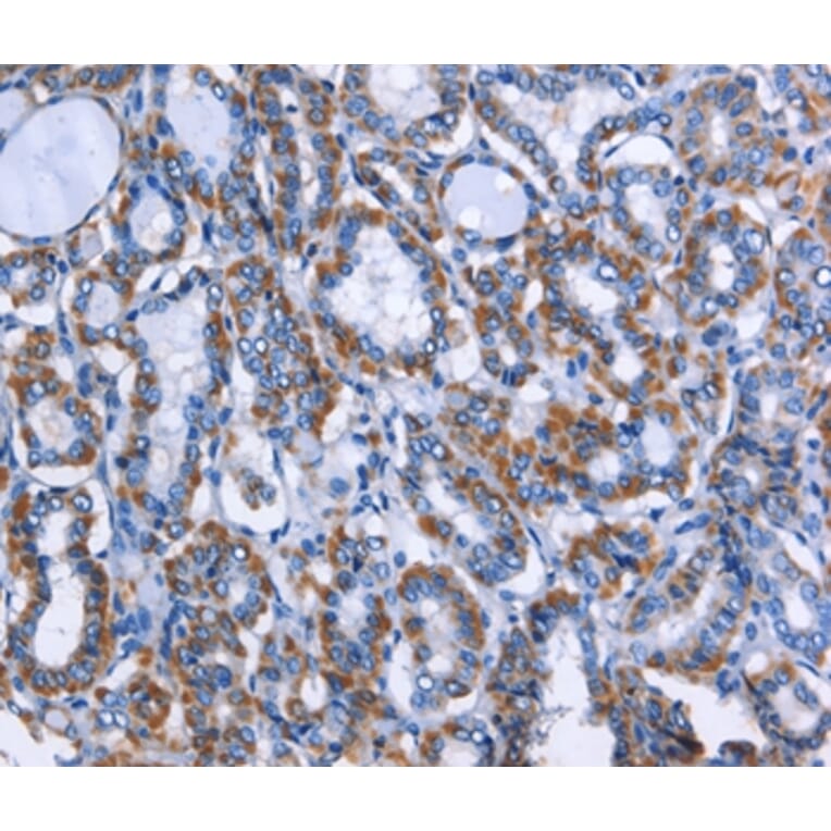 Immunohistochemistry - MPO Antibody from Signalway Antibody (35820) - Antibodies.com
