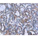 Immunohistochemistry - MPO Antibody from Signalway Antibody (35820) - Antibodies.com