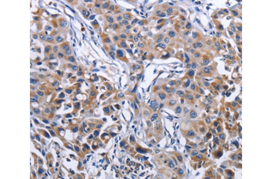 Immunohistochemistry - MPO Antibody from Signalway Antibody (35820) - Antibodies.com