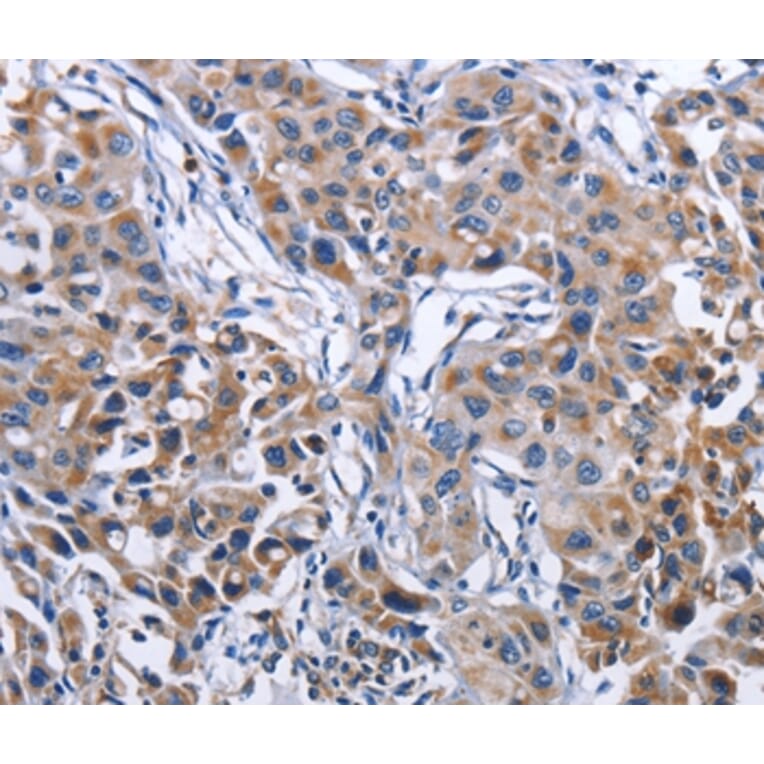 Immunohistochemistry - MPO Antibody from Signalway Antibody (35820) - Antibodies.com