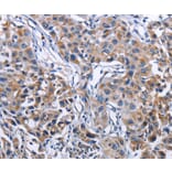Immunohistochemistry - MPO Antibody from Signalway Antibody (35820) - Antibodies.com