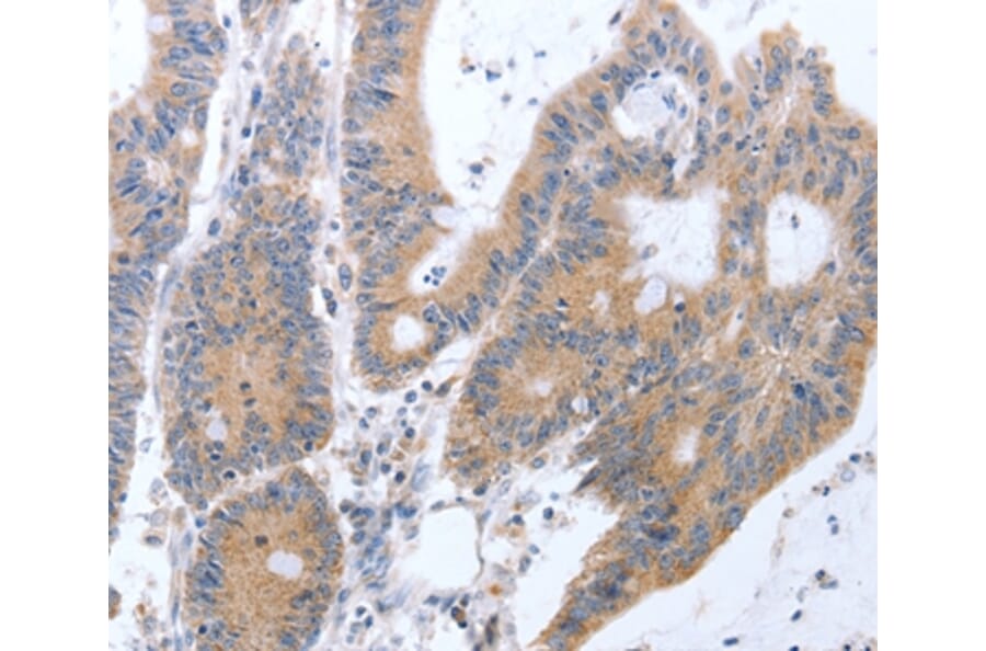 Immunohistochemistry - TAT Antibody from Signalway Antibody (35946) - Antibodies.com