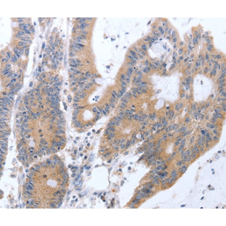 Immunohistochemistry - TAT Antibody from Signalway Antibody (35946) - Antibodies.com