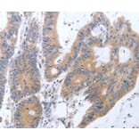 Immunohistochemistry - TAT Antibody from Signalway Antibody (35946) - Antibodies.com