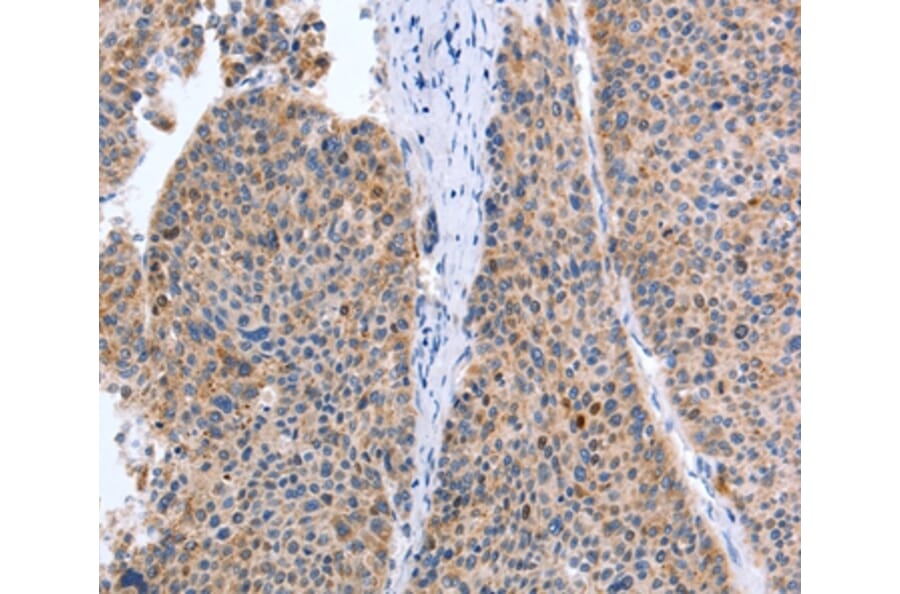 Immunohistochemistry - TAT Antibody from Signalway Antibody (35946) - Antibodies.com