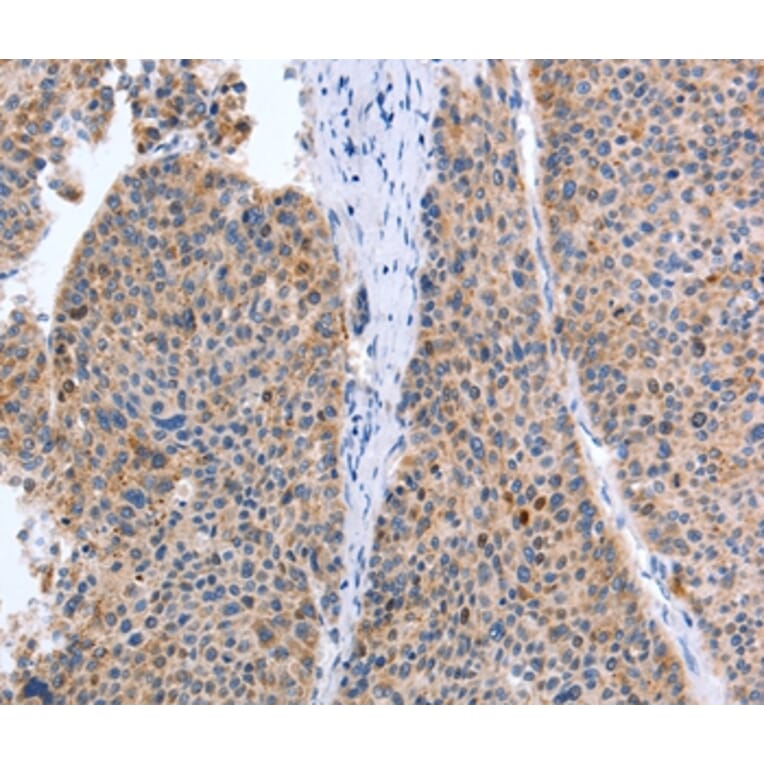 Immunohistochemistry - TAT Antibody from Signalway Antibody (35946) - Antibodies.com