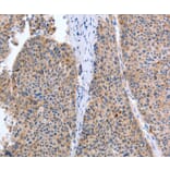 Immunohistochemistry - TAT Antibody from Signalway Antibody (35946) - Antibodies.com