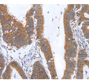 Immunohistochemistry - TNF Antibody from Signalway Antibody (35963) - Antibodies.com