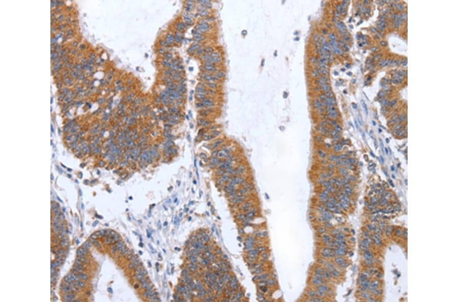 Immunohistochemistry - TNF Antibody from Signalway Antibody (35963) - Antibodies.com