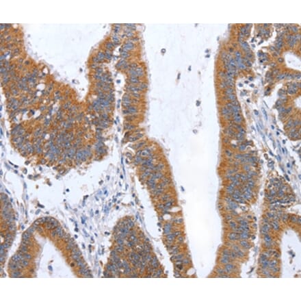 Immunohistochemistry - TNF Antibody from Signalway Antibody (35963) - Antibodies.com