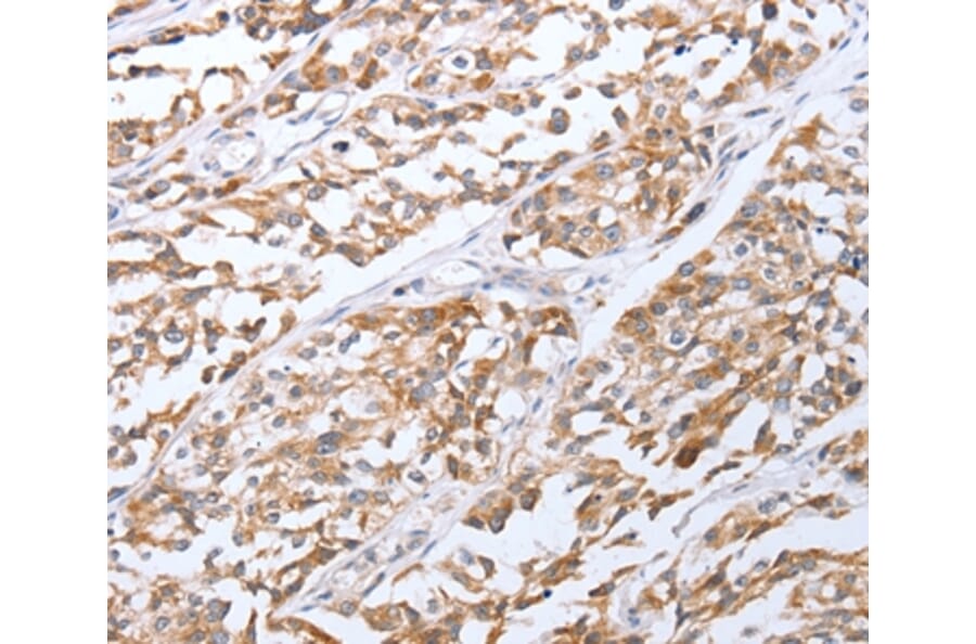 Immunohistochemistry - TNF Antibody from Signalway Antibody (35963) - Antibodies.com