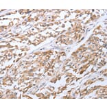 Immunohistochemistry - TNF Antibody from Signalway Antibody (35963) - Antibodies.com