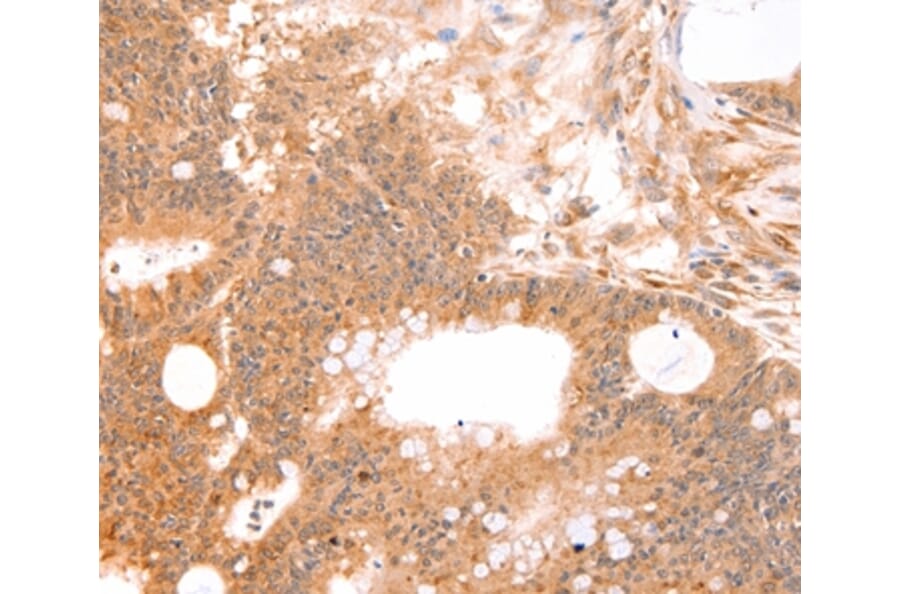 Immunohistochemistry - LTA Antibody from Signalway Antibody (35964) - Antibodies.com