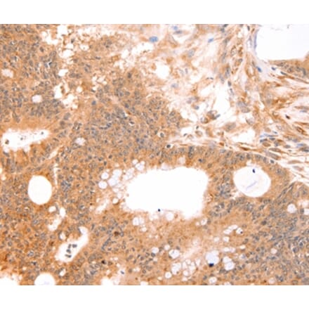 Immunohistochemistry - LTA Antibody from Signalway Antibody (35964) - Antibodies.com