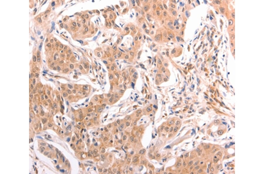 Immunohistochemistry - LTA Antibody from Signalway Antibody (35964) - Antibodies.com