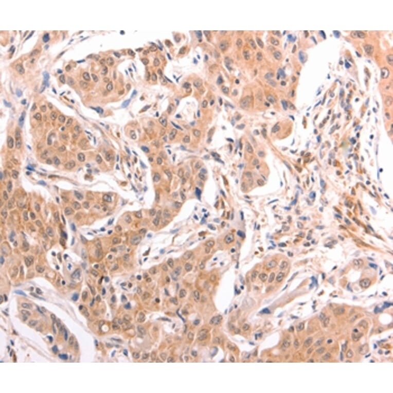 Immunohistochemistry - LTA Antibody from Signalway Antibody (35964) - Antibodies.com