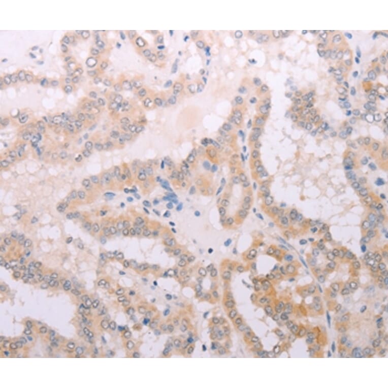 Immunohistochemistry - TPO Antibody from Signalway Antibody (35966) - Antibodies.com