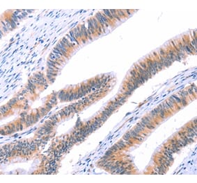 Immunohistochemistry - VWF Antibody from Signalway Antibody (35988) - Antibodies.com