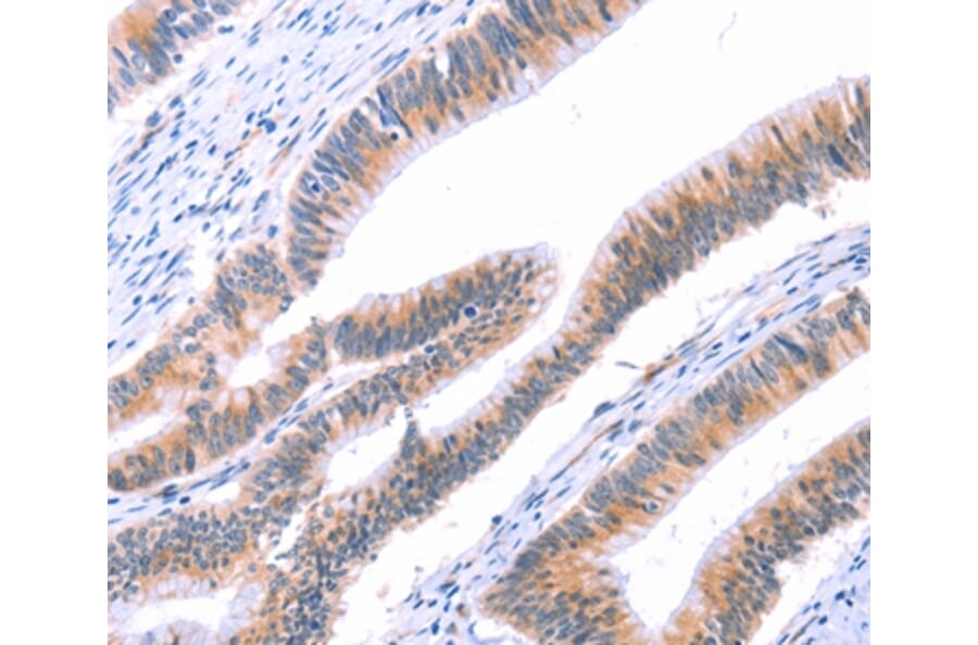 Immunohistochemistry - VWF Antibody from Signalway Antibody (35988) - Antibodies.com
