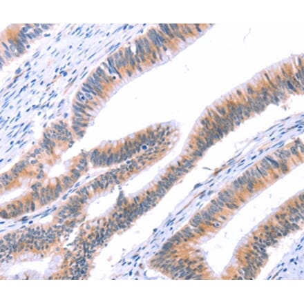 Immunohistochemistry - VWF Antibody from Signalway Antibody (35988) - Antibodies.com