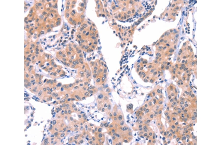 Immunohistochemistry - VWF Antibody from Signalway Antibody (35988) - Antibodies.com