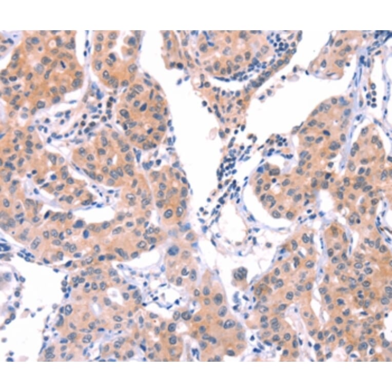Immunohistochemistry - VWF Antibody from Signalway Antibody (35988) - Antibodies.com