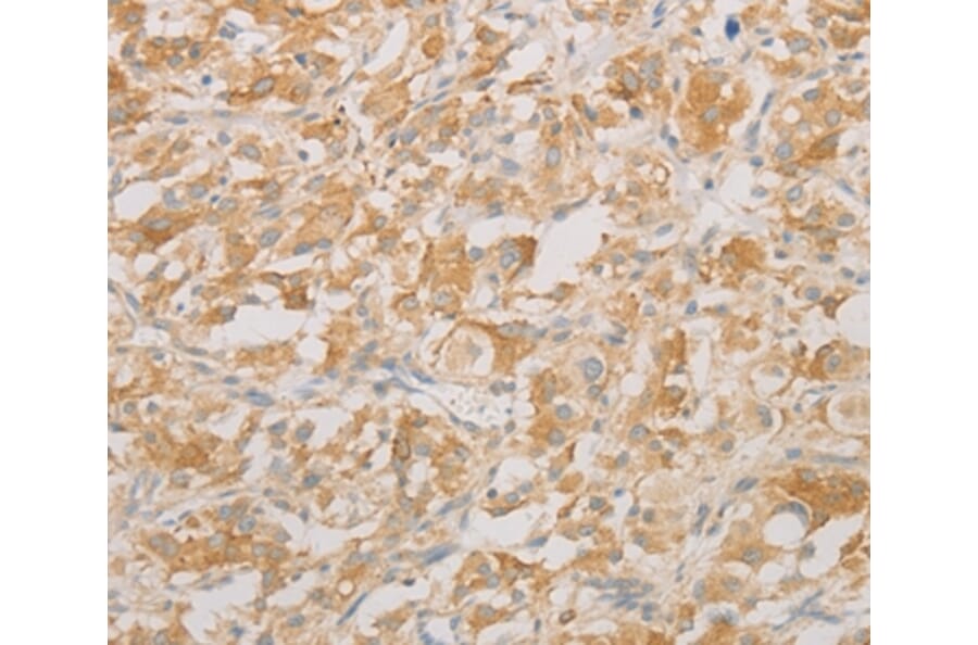 Immunohistochemistry - AES Antibody from Signalway Antibody (36095) - Antibodies.com