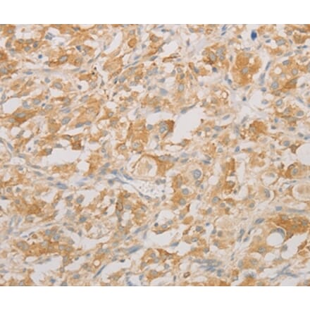 Immunohistochemistry - AES Antibody from Signalway Antibody (36095) - Antibodies.com