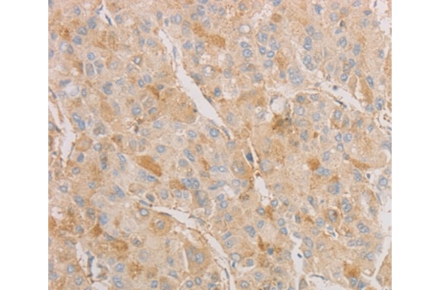 Immunohistochemistry - AES Antibody from Signalway Antibody (36095) - Antibodies.com