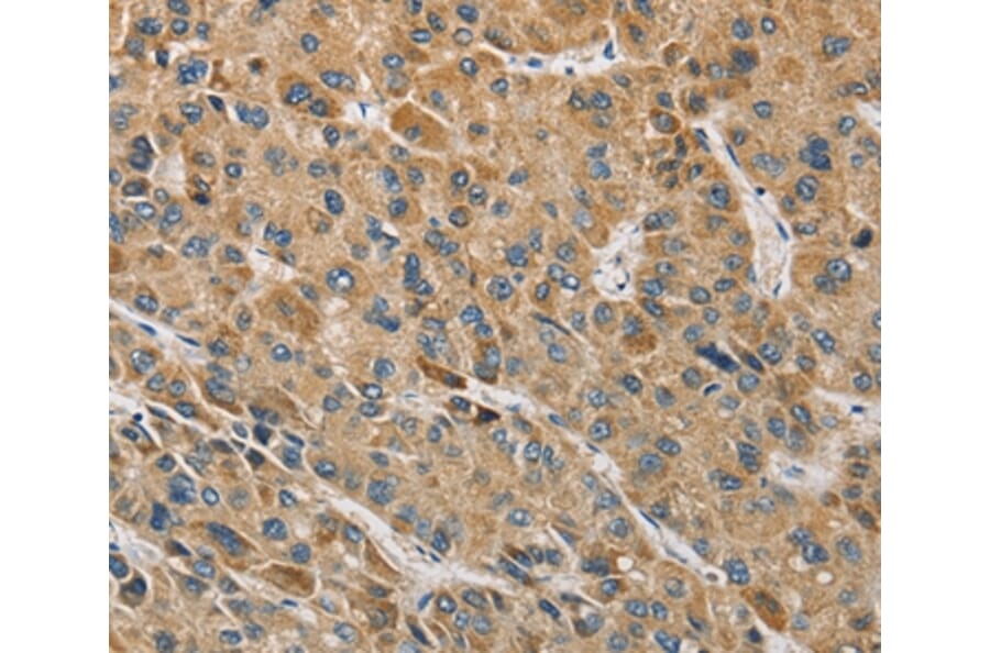 Immunohistochemistry - MIP Antibody from Signalway Antibody (36125) - Antibodies.com
