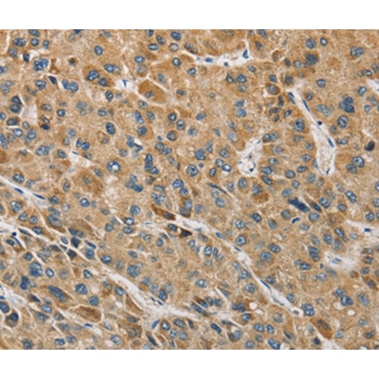 Immunohistochemistry - MIP Antibody from Signalway Antibody (36125) - Antibodies.com