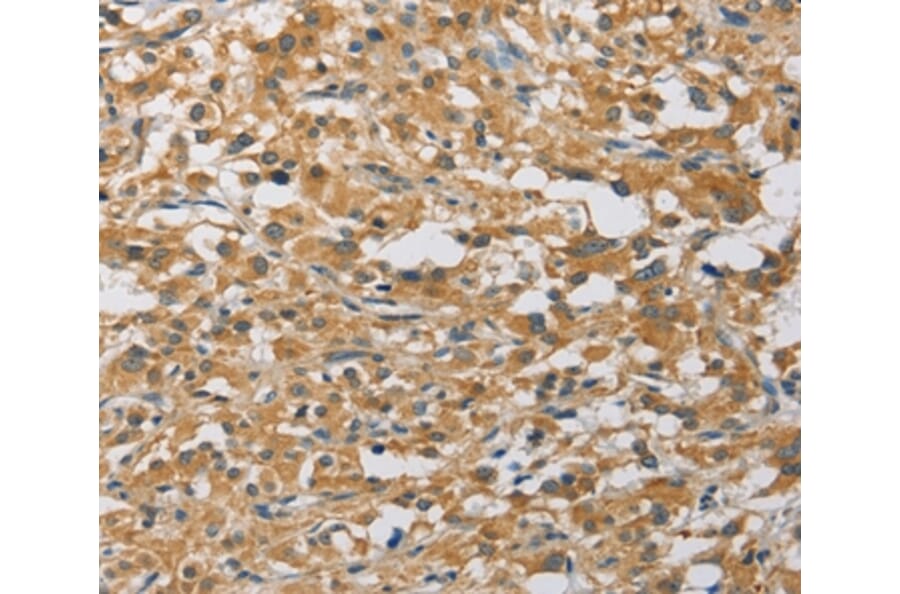 Immunohistochemistry - MIP Antibody from Signalway Antibody (36125) - Antibodies.com
