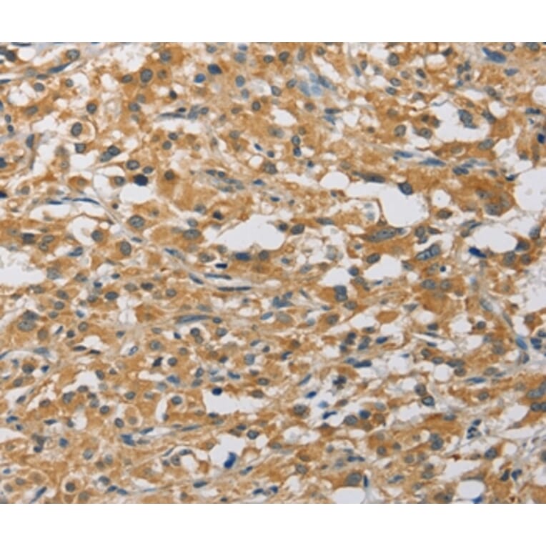 Immunohistochemistry - MIP Antibody from Signalway Antibody (36125) - Antibodies.com