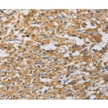 Immunohistochemistry - MIP Antibody from Signalway Antibody (36125) - Antibodies.com
