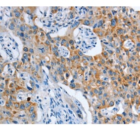 Immunohistochemistry - ASL Antibody from Signalway Antibody (36128) - Antibodies.com