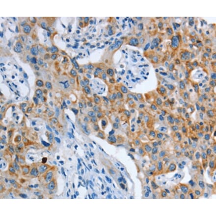 Immunohistochemistry - ASL Antibody from Signalway Antibody (36128) - Antibodies.com