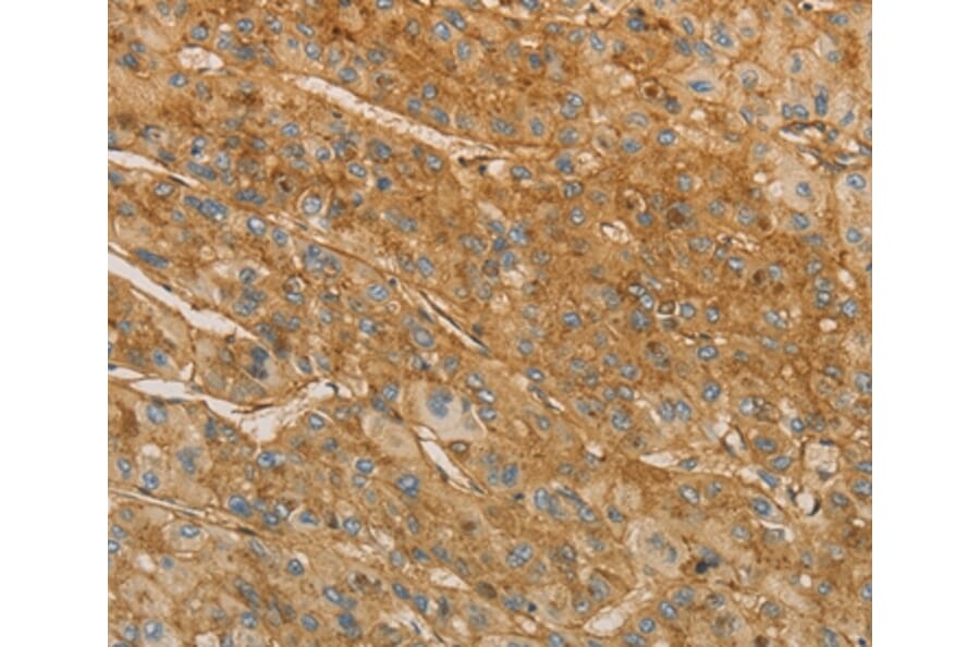 Immunohistochemistry - VTN Antibody from Signalway Antibody (36196) - Antibodies.com