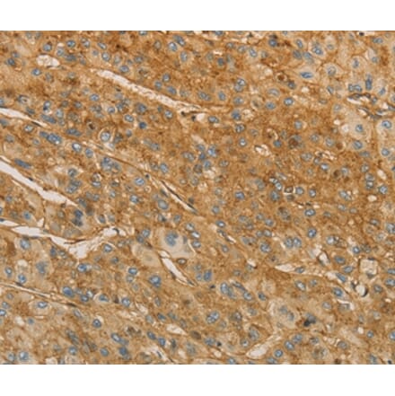 Immunohistochemistry - VTN Antibody from Signalway Antibody (36196) - Antibodies.com