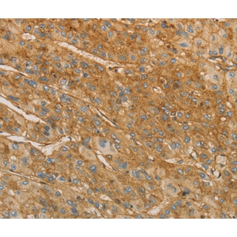 Immunohistochemistry - VTN Antibody from Signalway Antibody (36196) - Antibodies.com