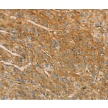 Immunohistochemistry - VTN Antibody from Signalway Antibody (36196) - Antibodies.com