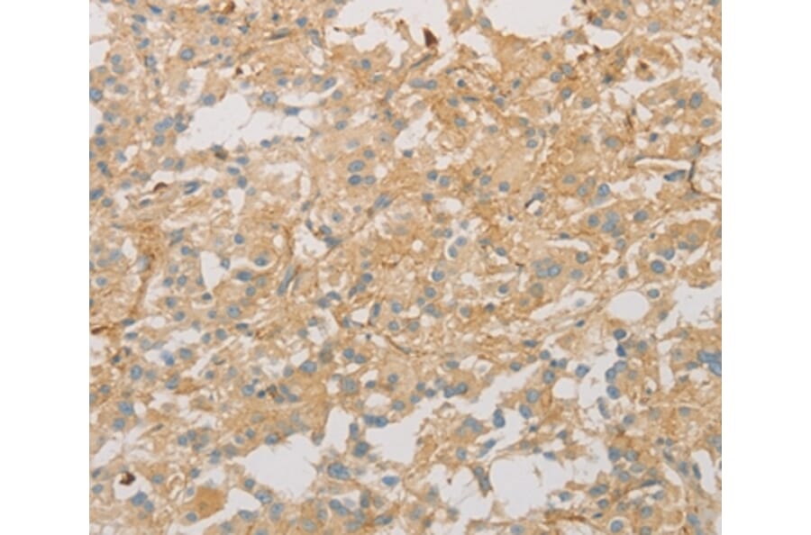 Immunohistochemistry - VTN Antibody from Signalway Antibody (36196) - Antibodies.com