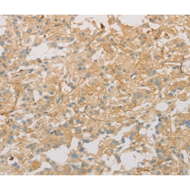 Immunohistochemistry - VTN Antibody from Signalway Antibody (36196) - Antibodies.com